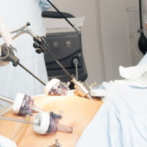 Laparoscopy and Hysteroscopy
